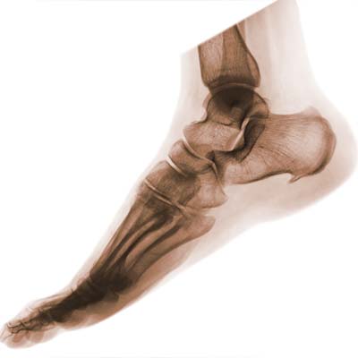členok a noha - ortopedické ochorenia a liečba
