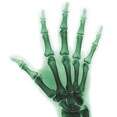 ochorenia a liečba ruka a zápästia